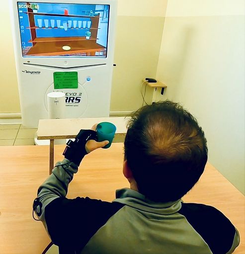 Ictus: osservare un’azione prima di riprodurla in realtà virtuale migliora recupero mano