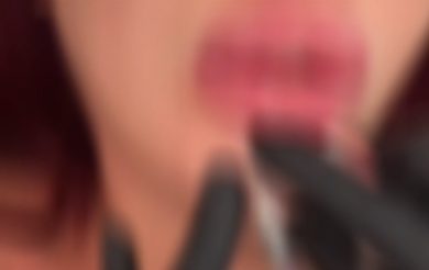 Si fingeva medico estetico e compieva interventi con il botox: denunciata una 40enne catanese