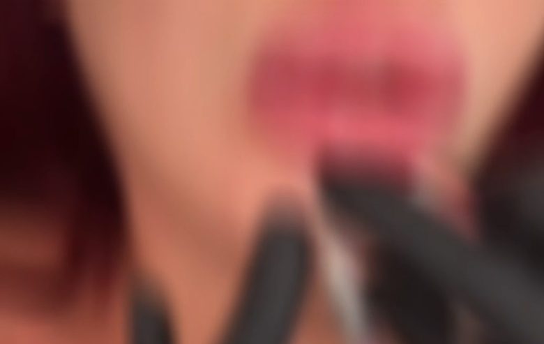 VIDEO | Interventi con botox e filler senza avere il titolo: denunciata 40enne a Catania