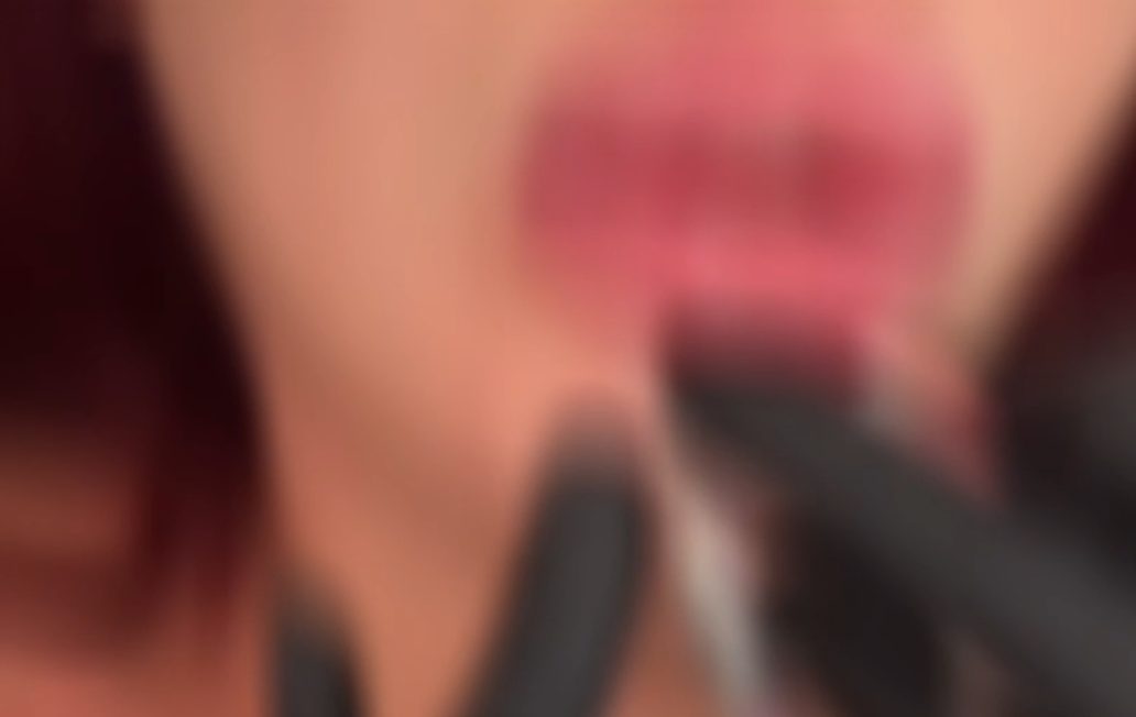 VIDEO | Interventi con botox e filler senza avere il titolo: denunciata 40enne a Catania