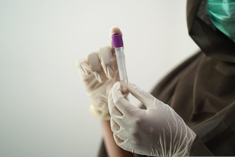 Hantavirus Andes, via ai test diagnostici: ecco i laboratori di riferimento in Sicilia