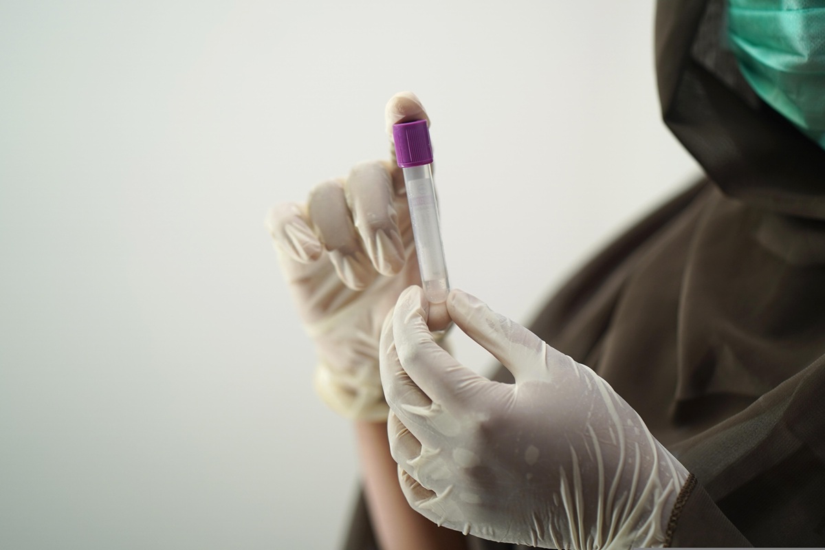 Hantavirus Andes, via ai test diagnostici: ecco i laboratori di riferimento in Sicilia Hantavirus Andes, via ai test diagnostici: ecco i laboratori di riferimento in Sicilia