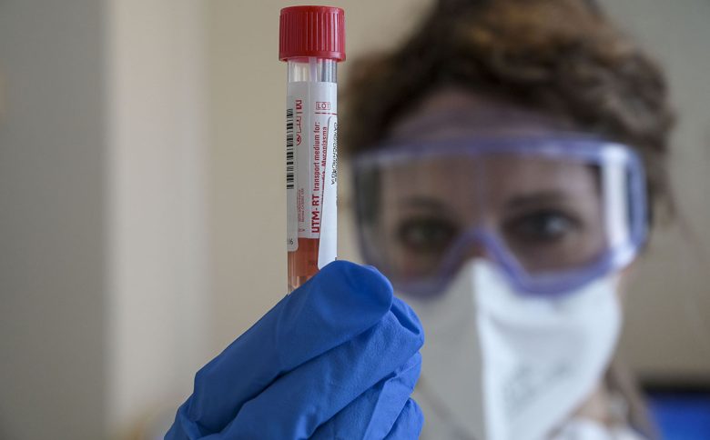 Hantavirus, quali sono i sintomi? Tutto sulla malattia che inquieta il mondo
