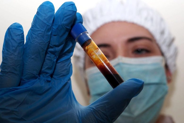 Hantavirus, negativi turista inglese in quarantena e accompagnatore a Milano