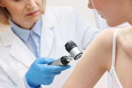 Sidemast: negare che raggi uv causino i melanomi è mistificazione